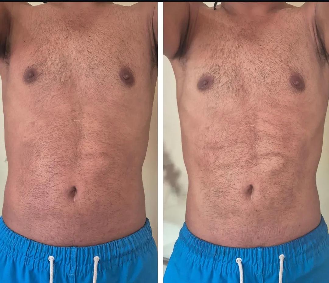 Definição abdominal masculina